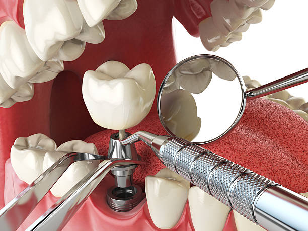 Best Emergency Treatment for Dental Infections or Abscesses in West Jefferson, NC